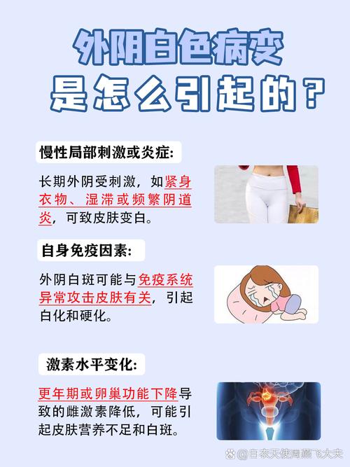 妇科白斑能治好吗_妇科白斑病是因为什么原因引起的