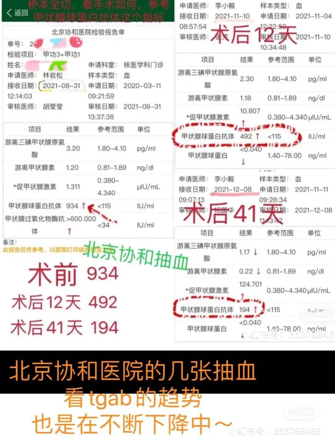 TG与TGAb的简单介绍