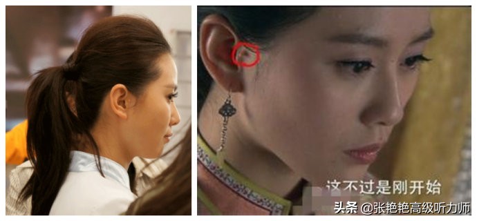 耳朵老是听见类似于电报的声音-耳朵老是听见类似于电报的声音是什么病